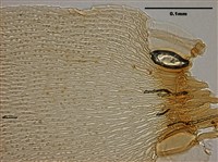 Acanthorrhynchium papillatum Collection Image, Figure 8, Total 10 Figures